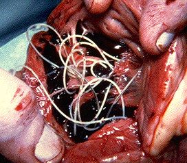 Click Here To See the NEXT image ( 1 ) ( Human Worms and other parasites ) 