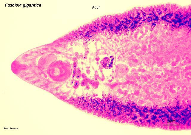 Click Here To See the NEXT image ( 40 ) ( Human Worms and other parasites ) 