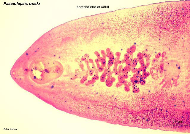 Click Here To See the NEXT image ( 41 ) ( Human Worms and other parasites ) 