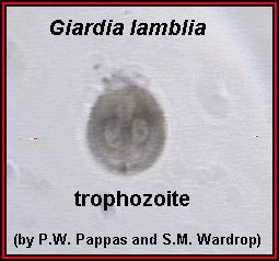 Click Here To See the NEXT image ( 42 ) ( Human Worms and other parasites ) 