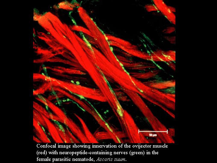 Click Here To See the NEXT image ( 51 ) ( Human Worms and other parasites ) 