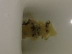 After coffee enema, then garlic enema, then this is candida that came out a few hours later (part 2) ... (Click to enlarge)