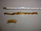 intestinal worms after enema ... (Click to enlarge)