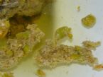 Gallstones Encapsulated by Psyllium Husk (modded cleanse) ... (Click to enlarge)