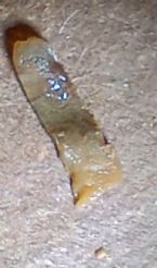 Possible Parasite ... (Click to enlarge)