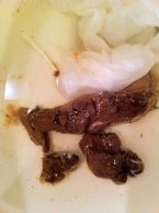 Worms ? in stool ... (Click to enlarge)