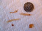 Tapeworm Photo1 ... (Click to enlarge)