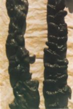 Mucoid Plaque. Photo from Dr. Jensen's  Bowel Management Book ... (Click to enlarge)