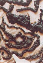 Mucoid Plaque. Photo from Dr. Jensen's  Bowel Management Book ... (Click to enlarge)