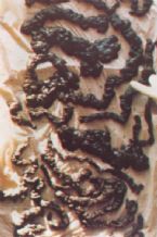 Mucoid Plaque. Photo from Dr. Jensen's  Bowel Management Book ... (Click to enlarge)